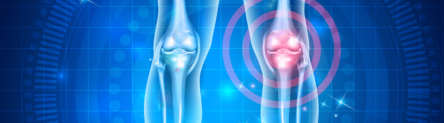 3 Startling Facts About Cartilage You Wish You'd Known Sooner